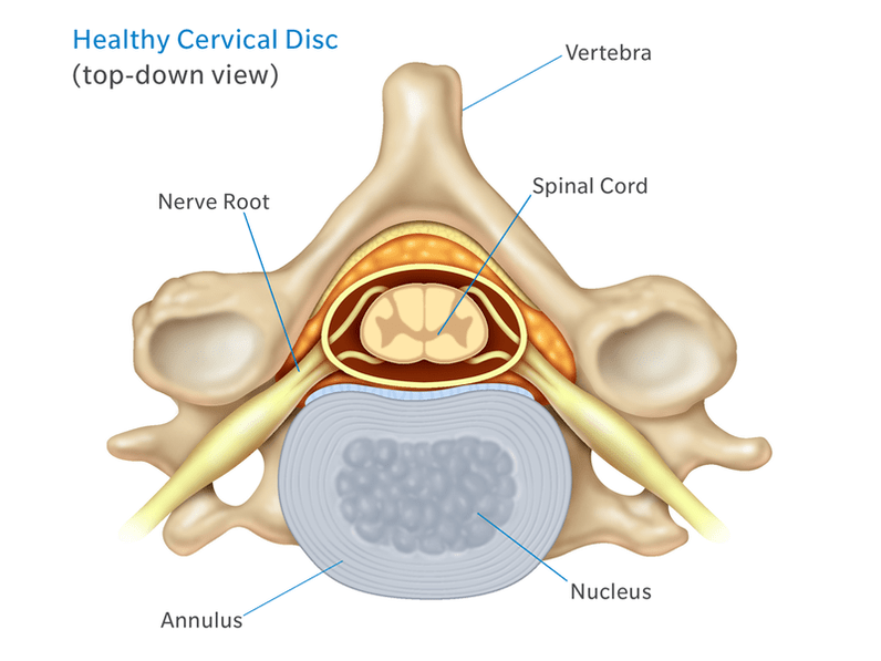 Intervertebral disk structure
