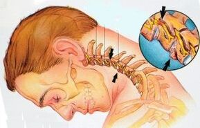 Cervical ward