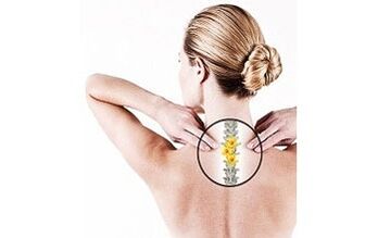 cervical osteochondrosis in women